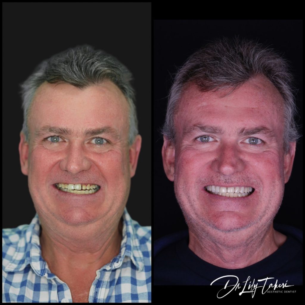 After digital smile design - connolly dental