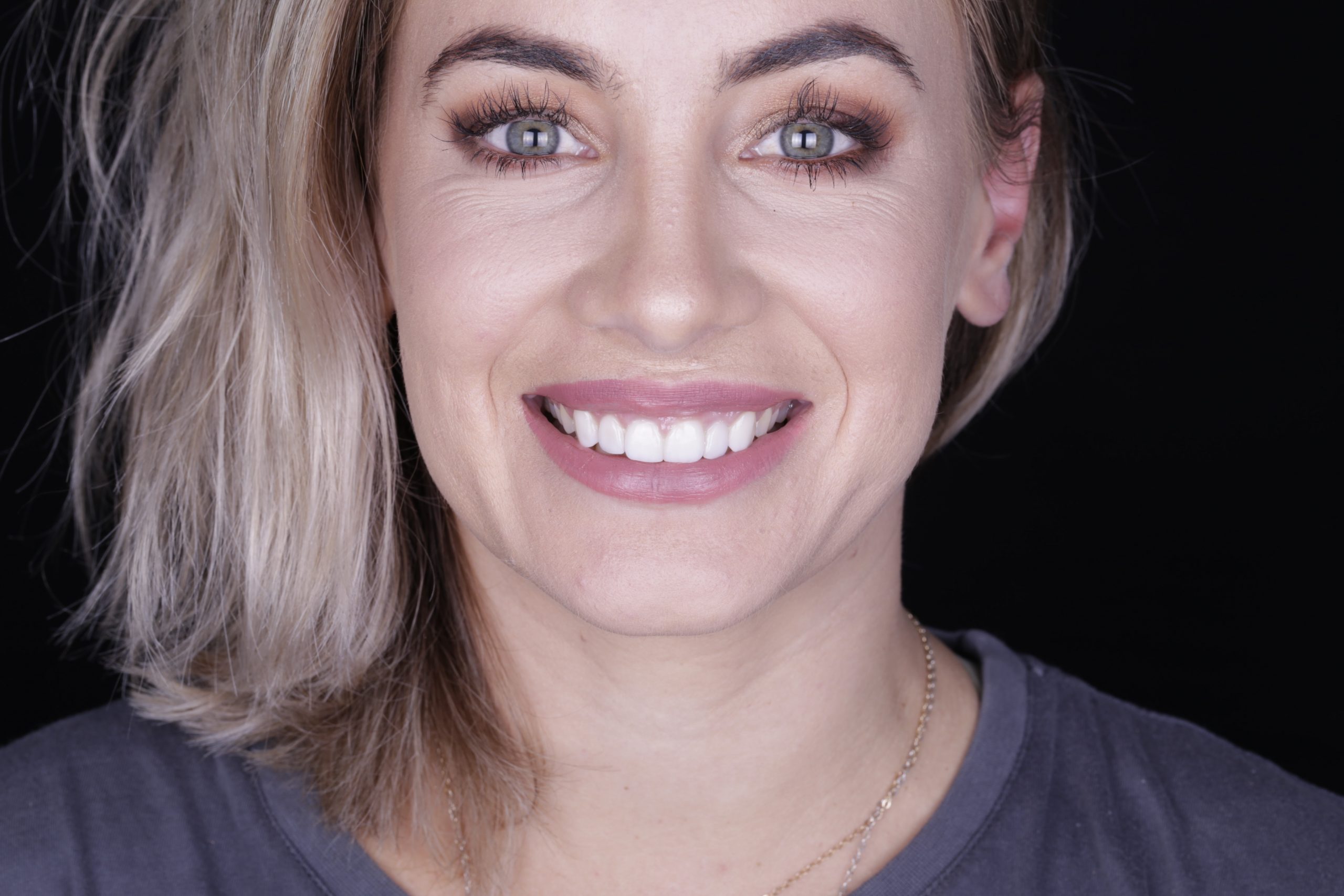 Professional InChair Teeth Whitening Perth Connolly Dental