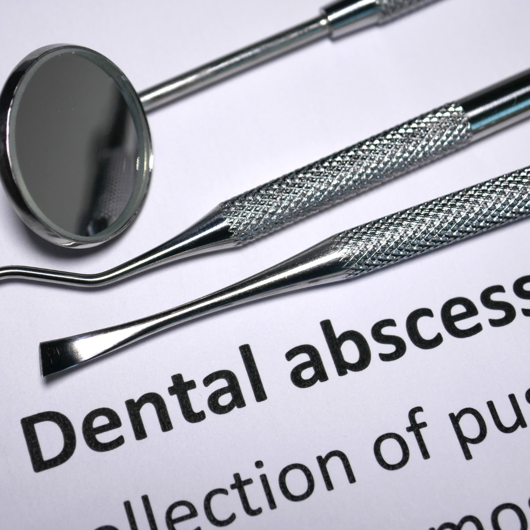 Emergency Dental Abscess Treatment Connolly Dental