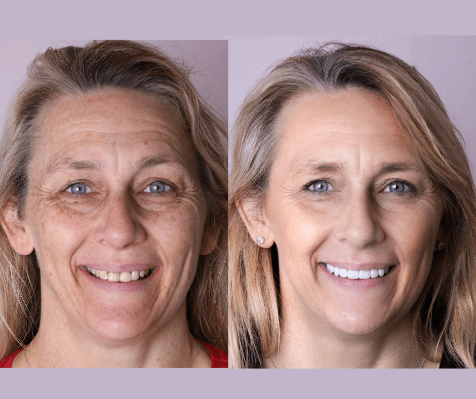 Best Smile makeover Perth - Connolly Dental