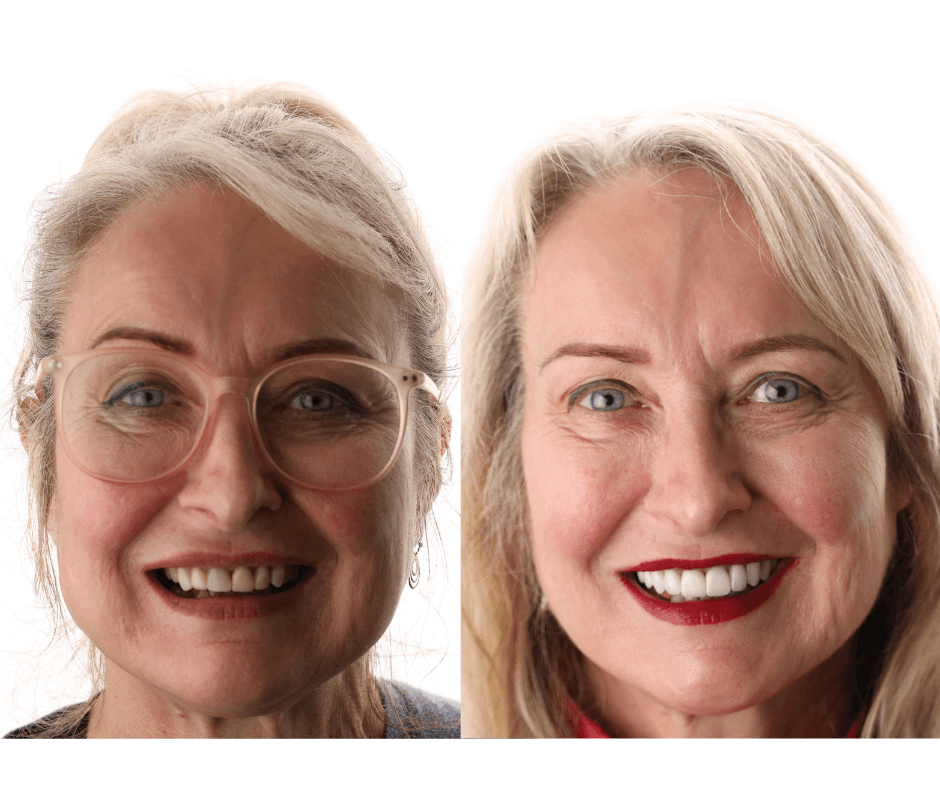Best Smile makeover Perth WA - Connolly Dental