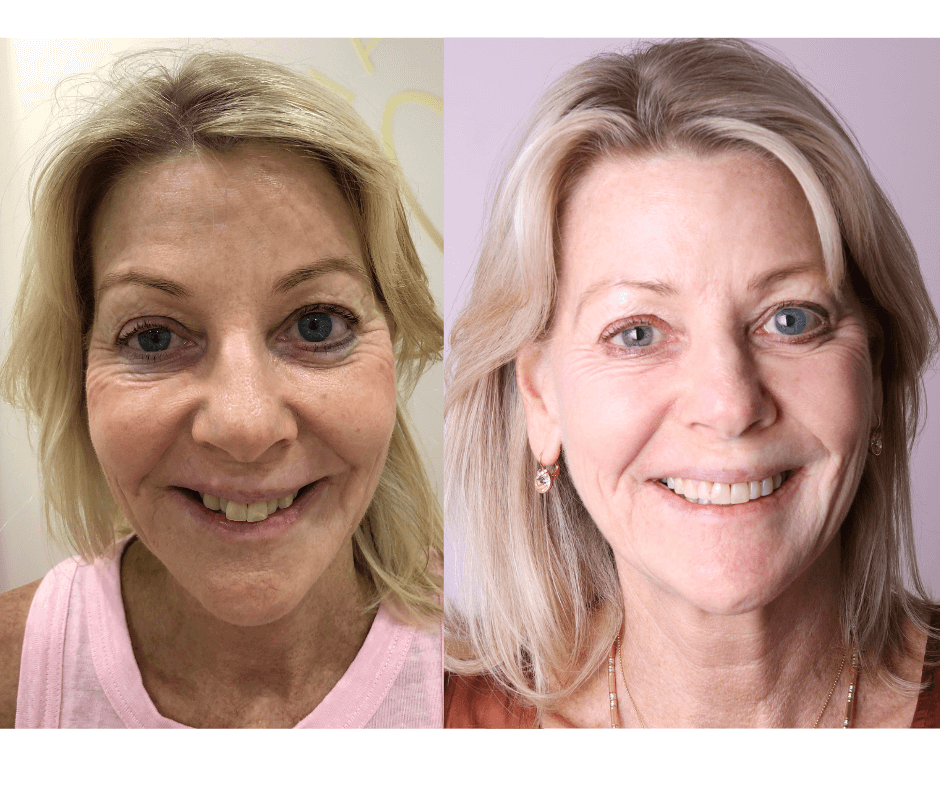 Best Smile makeover Perth WA - Connolly Dental