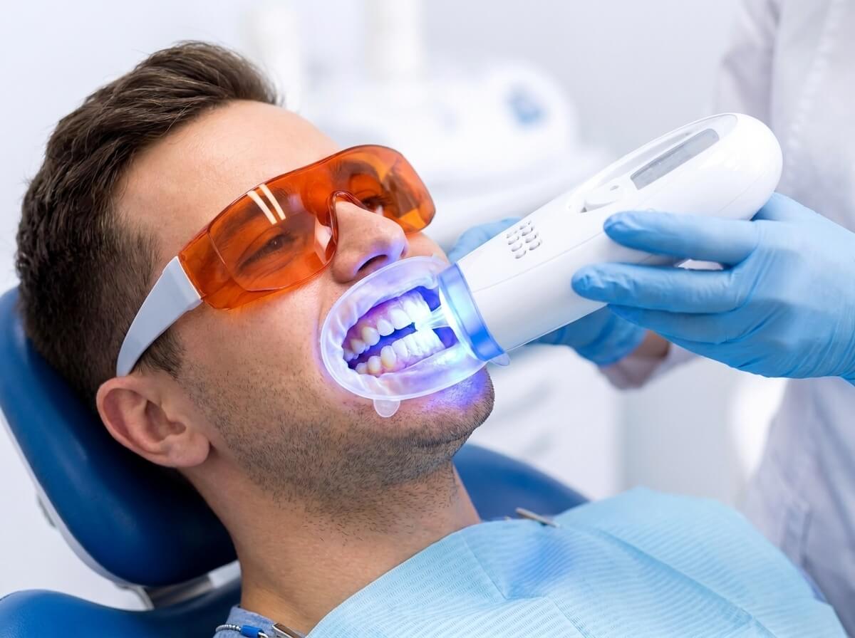 Teeth Whitening Perth treatment at Connolly Dental