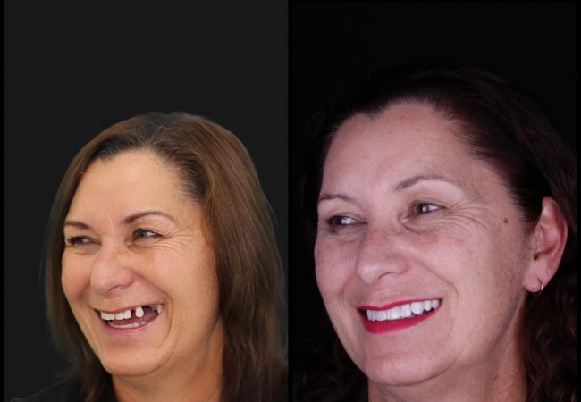 After digital smile design - connolly dental